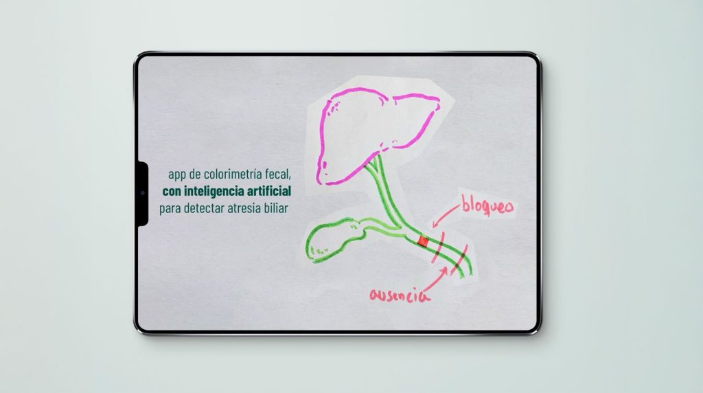 Atresia biliar. Sociedad Latinoamericana de Gastroenterología Pediátrica